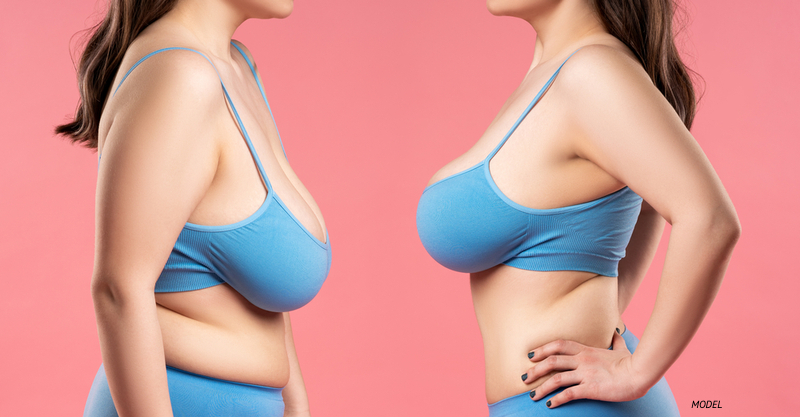 A decrease in breast augmentation? Not good for Victoria's Secret